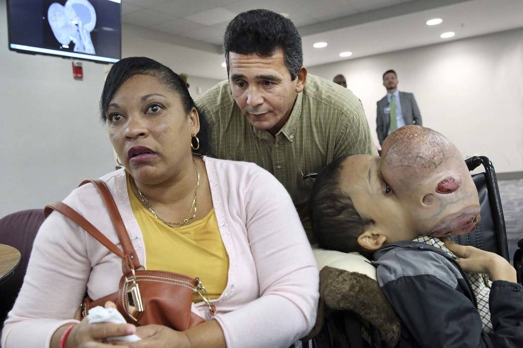 Emanuel Zayas Dies After Doctors Remove 10-pound Tumor From His Face