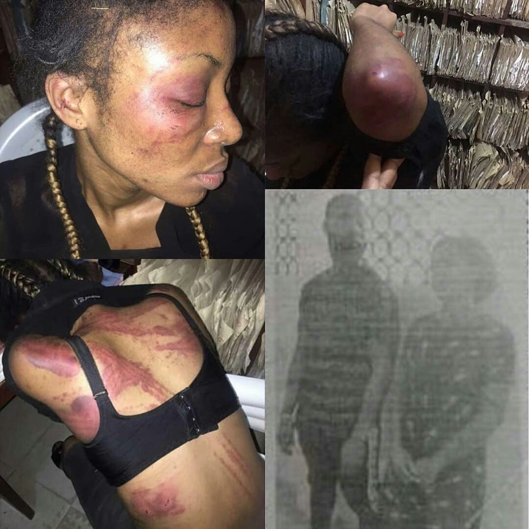 Couple-Arrested-For-Beating-Sister-In-Law-To-Coma-TrendysturvsBlog