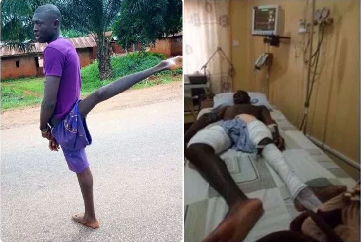 Nigerian_Man_Undergoes_Surgery_TrendysturvsBlog