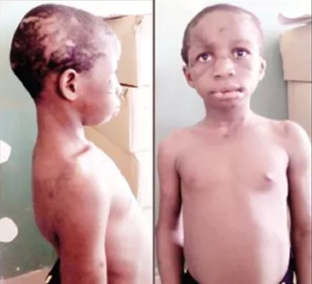 Childles-Woman-Tortures-Adopted-Daughter-tsb.com.ng