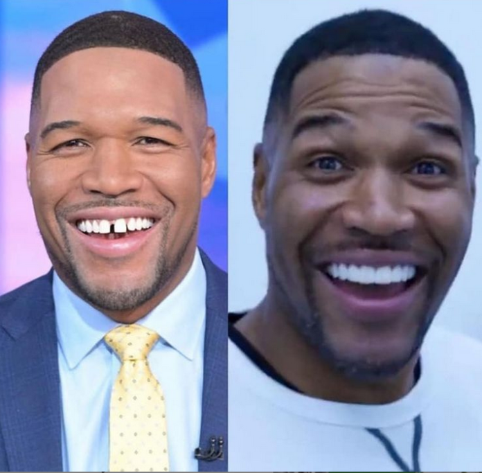 Former Nfl Player Michael Strahan Closes His Signature Gap Tooth Video 