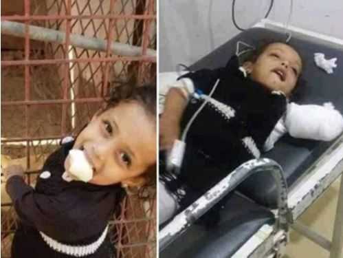 Lion bites off 2-year-old girl's hand in Yemen zoo