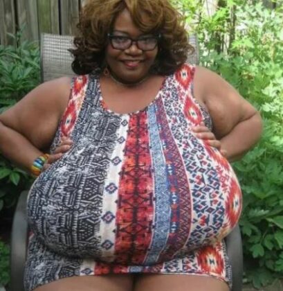 Woman with world's biggest bosoms, Annie Hawkins-Turner says | tsbnews.com