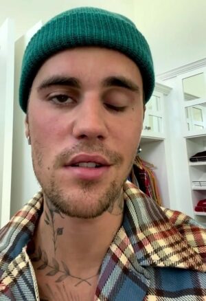 Justin Bieber Reveals He Has Facial Paralysis From Ramsay Hunt Syndrome Tsbnews Com