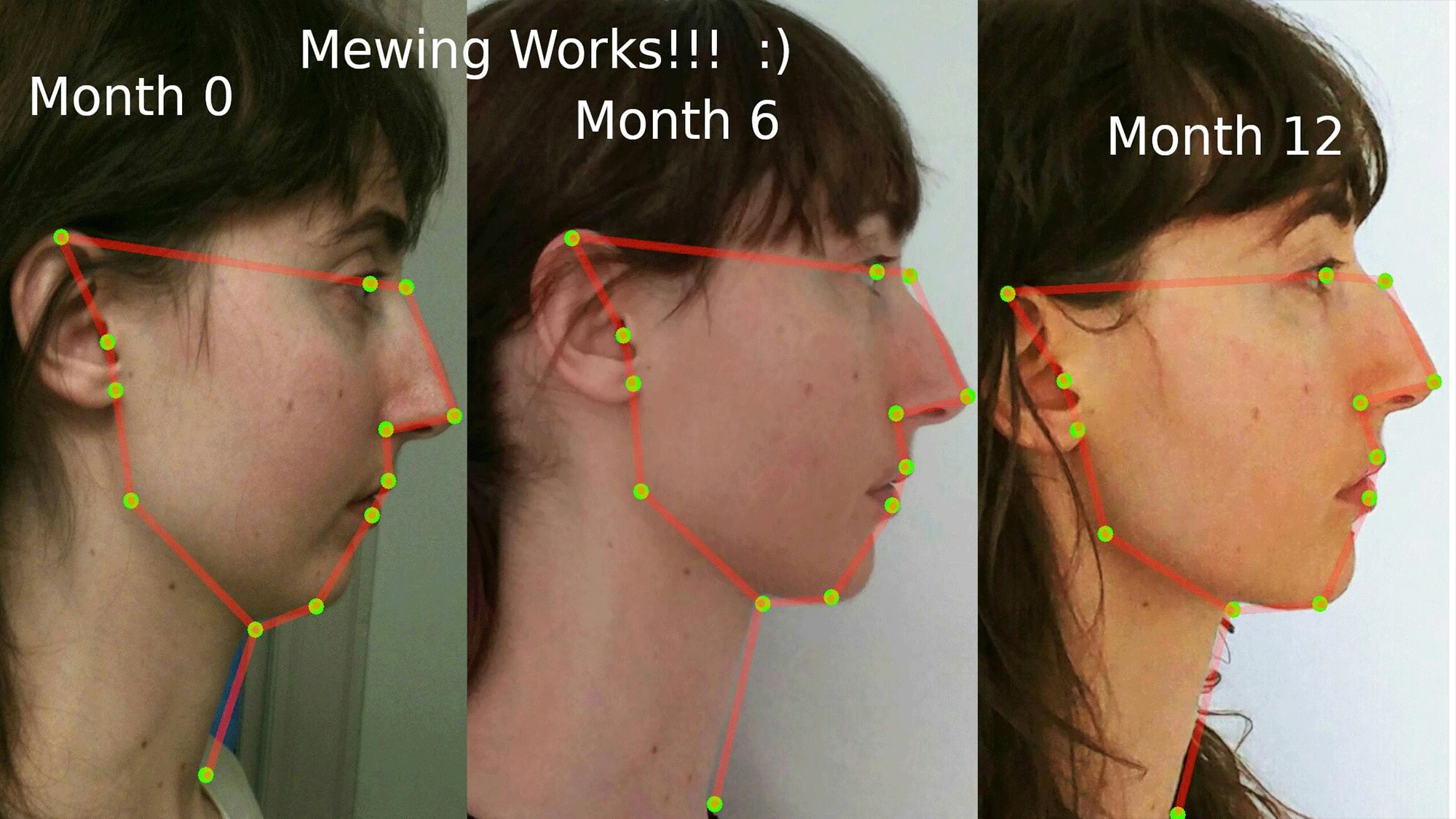 Mewing: The TikTok Trend That Helps You Improve Your Jawline | Tsbnews.com