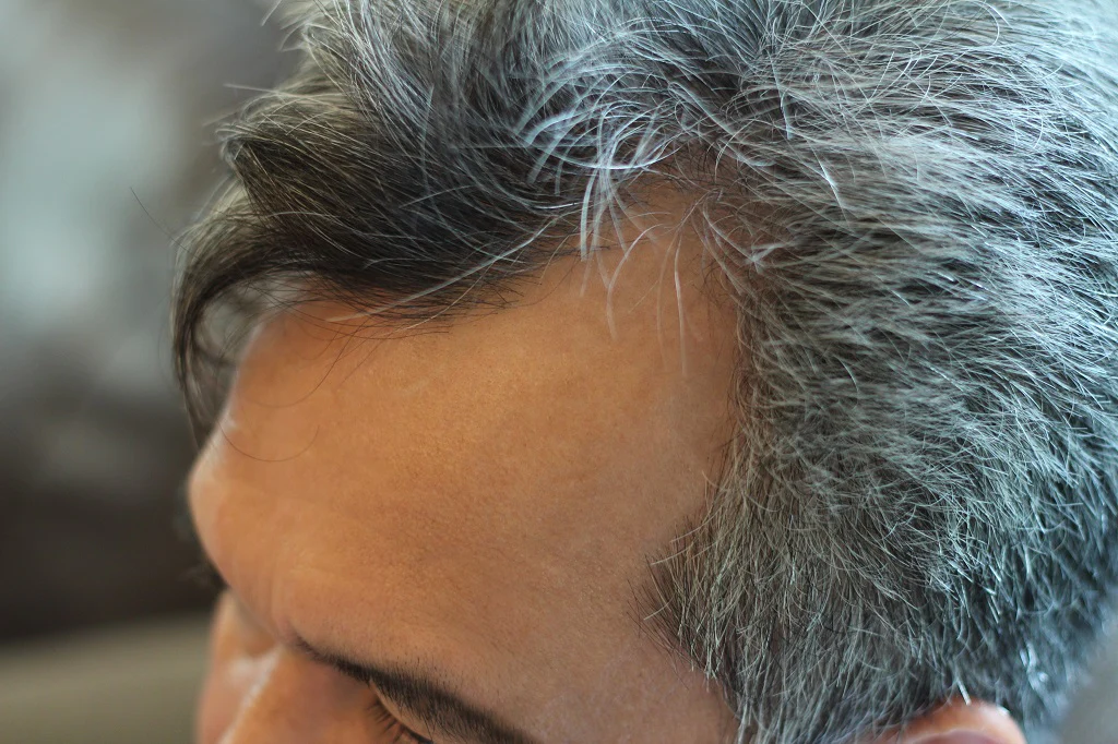 Scientists have discovered the real reason hair turns grey