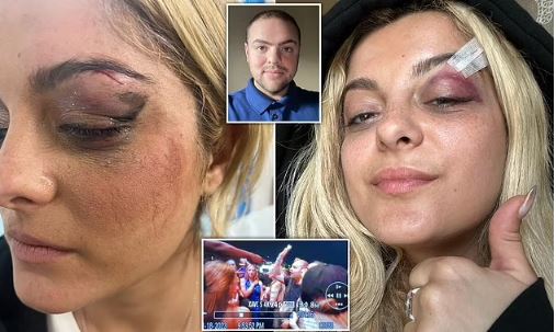Bebe Rexha shows off her painful injuries after being hit in the face with a PHONE during concert in NYC