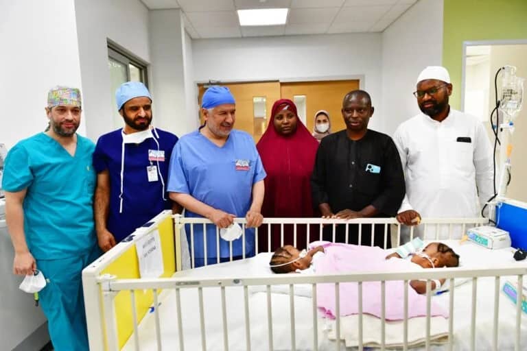 Conjoined Nigerian twins separated in Saudi Arabia