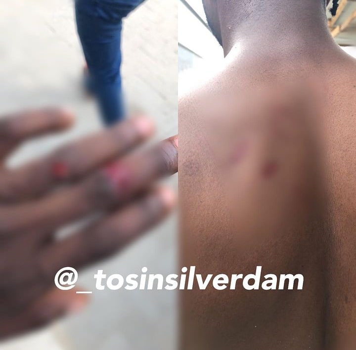 Drama as Mr Ibu’s son and brother allegedly engage in messy fight over his properties, sustain injuries (Photos)