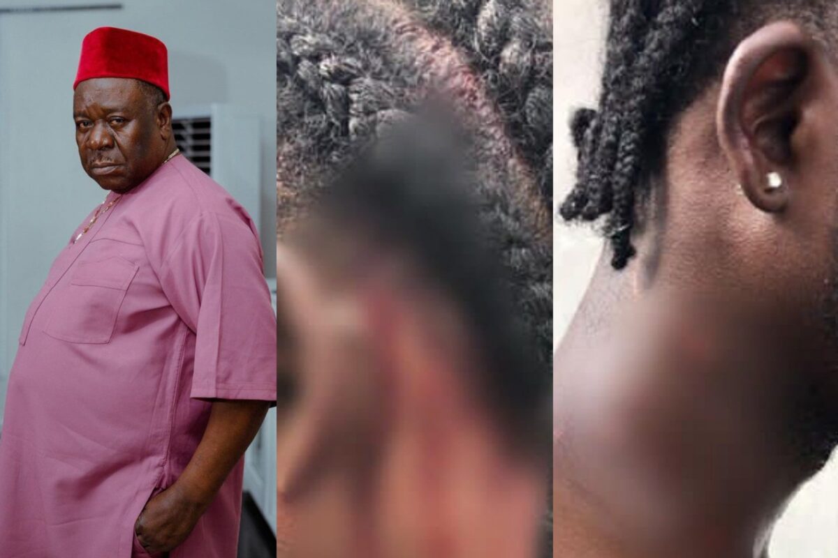 Drama as Mr Ibu’s son and brother engage in fight over his properties, sustain injuries (Photos)