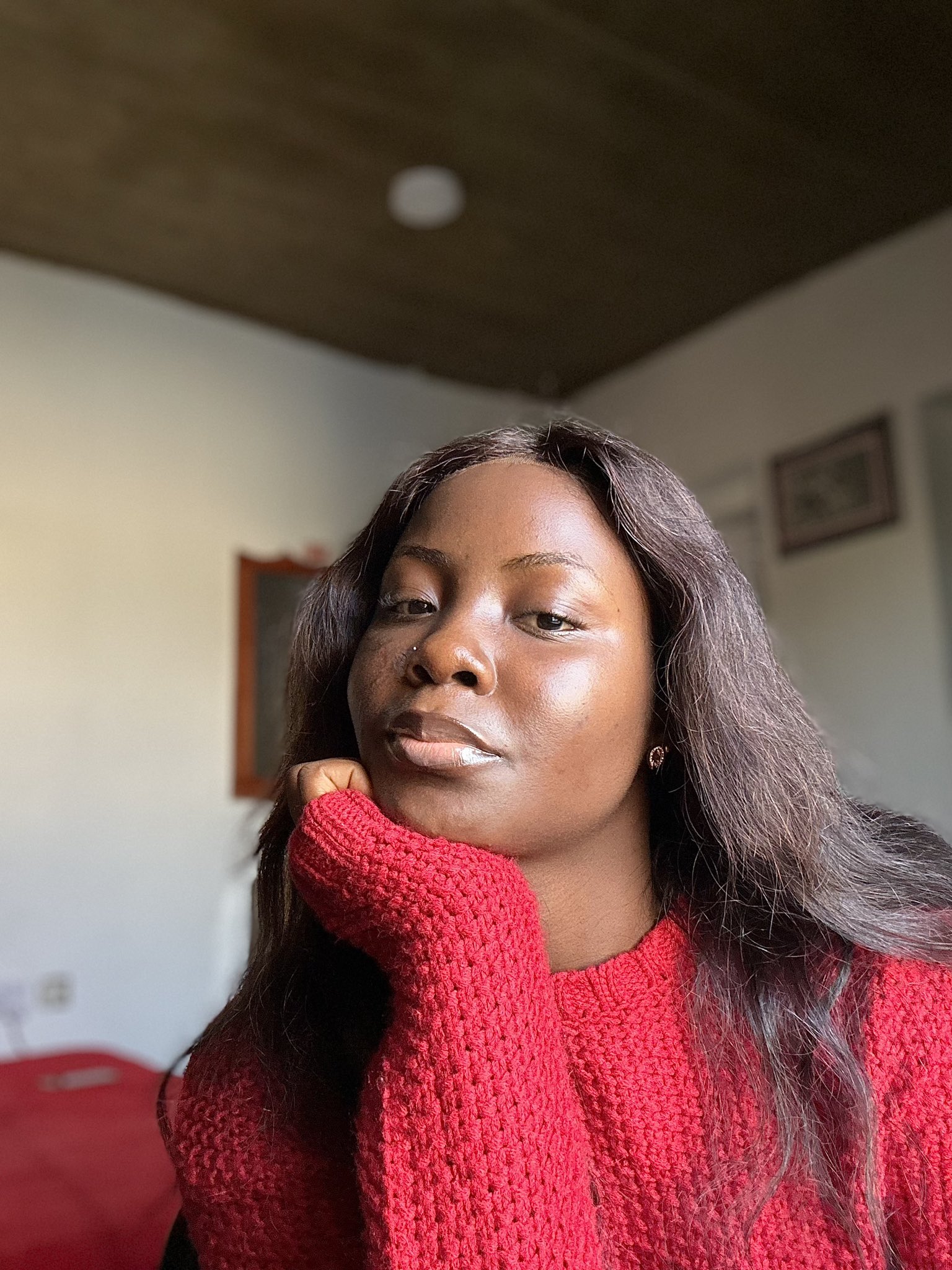 ‘I was rejected for movie role because of my facial scar’ — Jemima Adelekan cries out