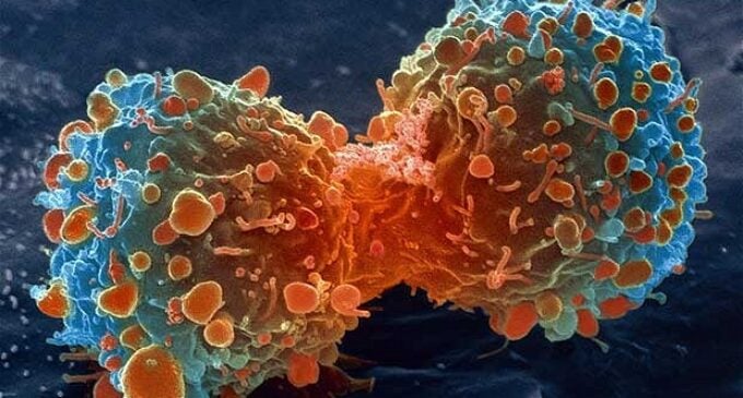 Scientists discover blood proteins that could warn of cancer years before diagnosis