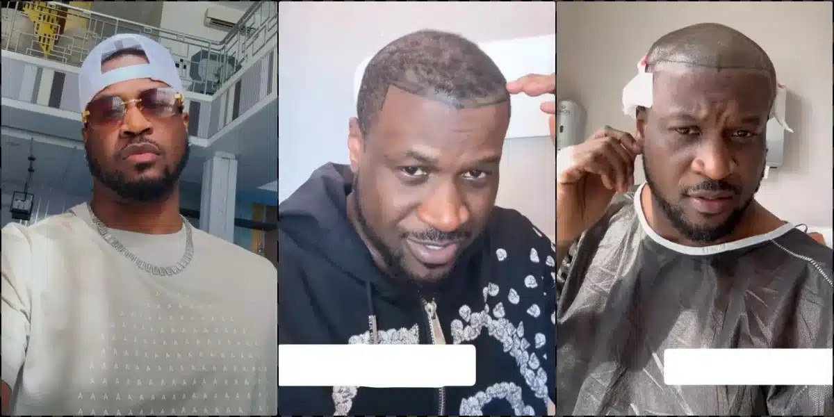 Singer Peter Okoye Undergoes Hair Transplant In Turkey